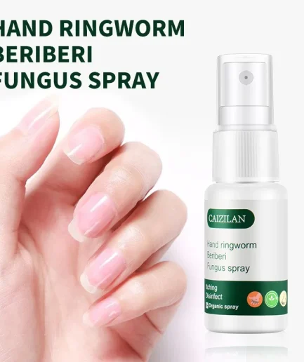 무좀 Hand Ringworm Beriberi Fungus Spray Hand and Foot Skin Care Anti Itch Spray 20ml Itching Disinfect Personal Health Care