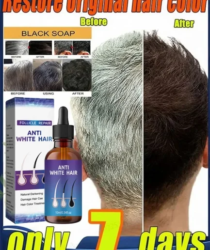 Grey Coverage Bar Shampoo Repair Gray Natural Anti-Grey Hair Essence Serum Smoothing Nourishing Dandruff Natural Darkening Soap