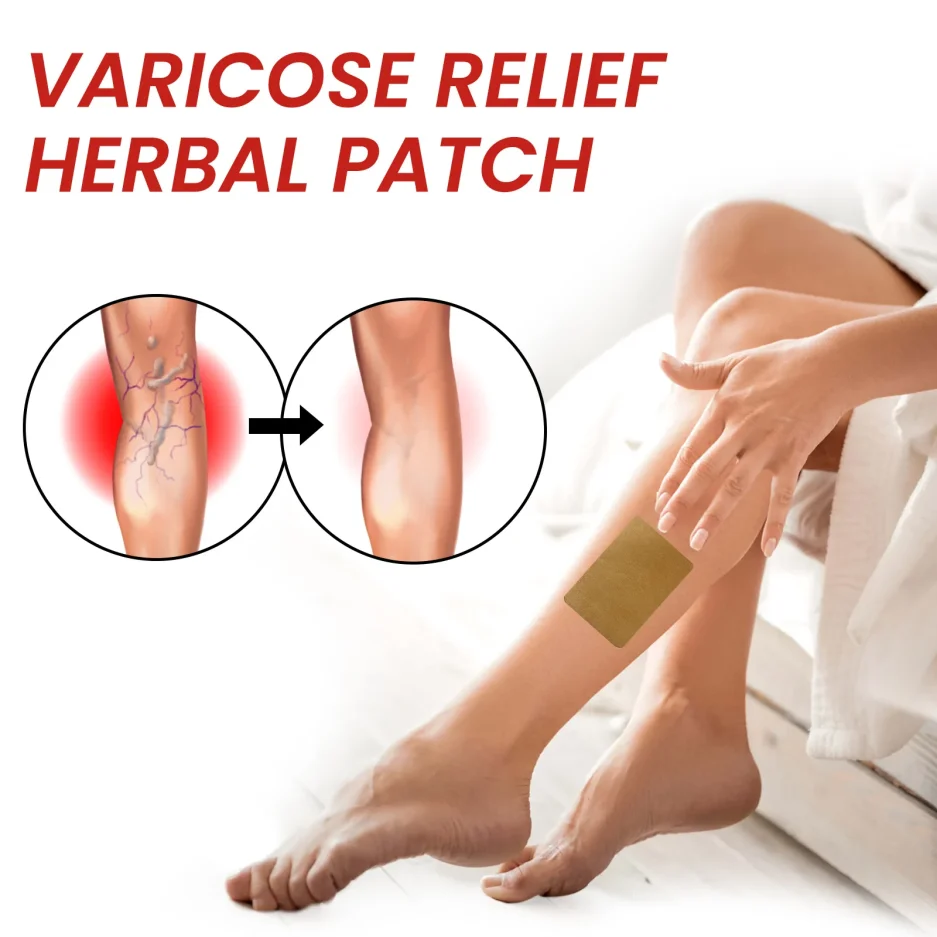 Varicose Vein Patch Circulation Paste for Legs Soothing Leg Treat Improves The Appearance of Varicose Vein Personal Health Care - Image 4