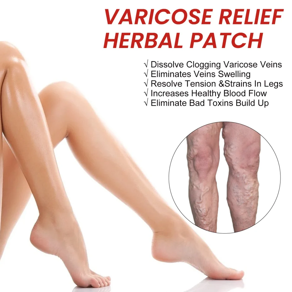 Varicose Vein Patch Circulation Paste for Legs Soothing Leg Treat Improves The Appearance of Varicose Vein Personal Health Care - Image 3